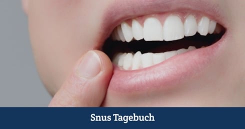 Jemand zeigt sein Zahnfleisch im Zusammenhang mit der Nutzung von Snus.